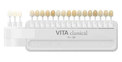 Tooth guide color extension